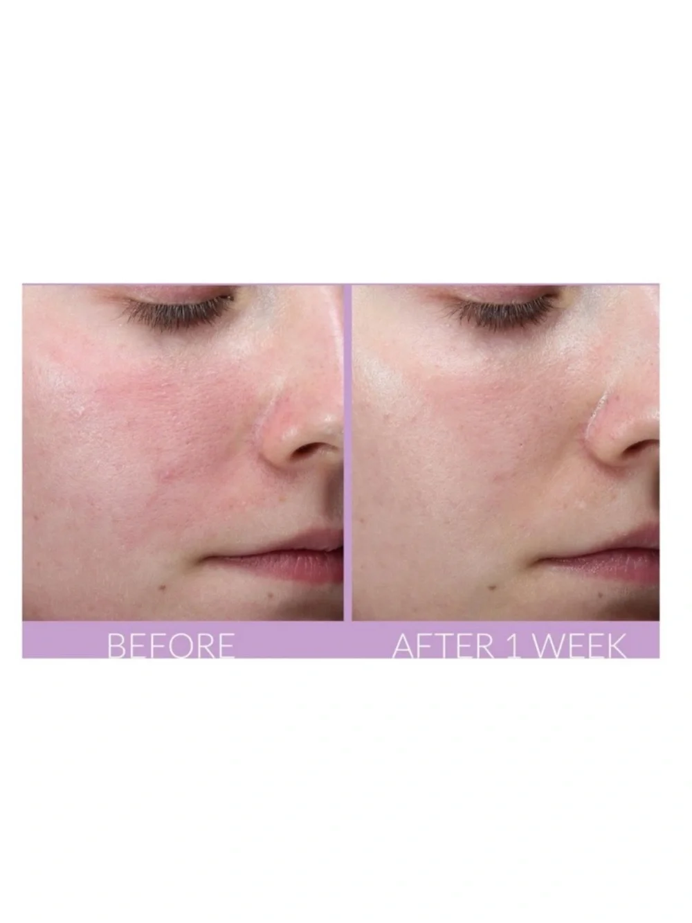 KATE SOMERVILLE DeliKate Recovery Serum 1oz NIB $98